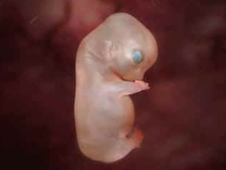 Embryo 29 Tage alt